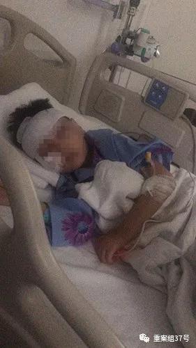 ▲被咬傷的5歲男孩童童。 &nbsp;&nbsp; 資料圖片