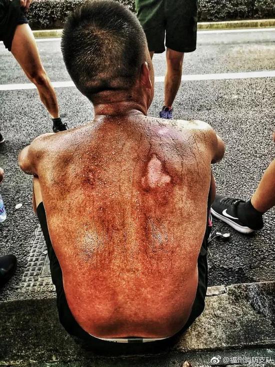 △來源：@福州消防支隊微博