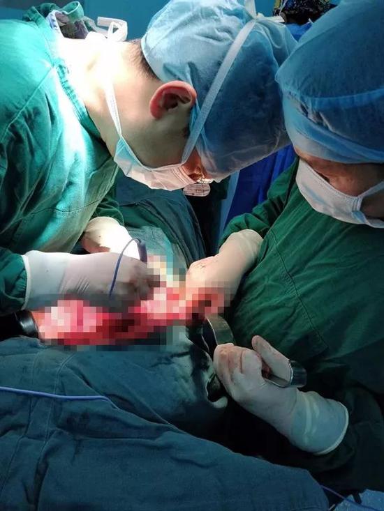 手術(shù)中的馮侃醫(yī)生（左）