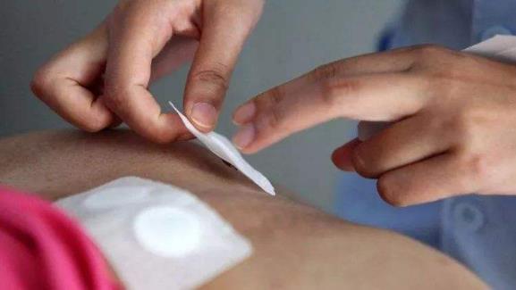 三伏貼每個人貼的中藥都一樣嗎?三伏貼貼的位置在哪里?