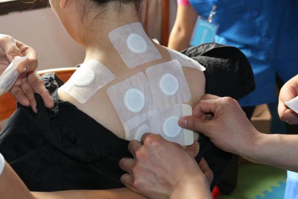 三伏貼每個人貼的中藥都一樣嗎?三伏貼貼的位置在哪里?