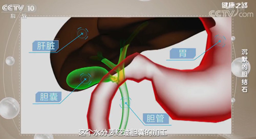 【名醫話健康】膽結石是怎樣形成的？除了長期不吃早餐，還有這些原因……