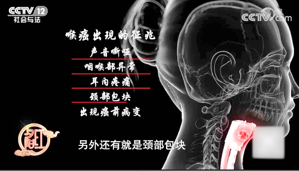 【快看·健康】喉癌出現的征兆有哪些？